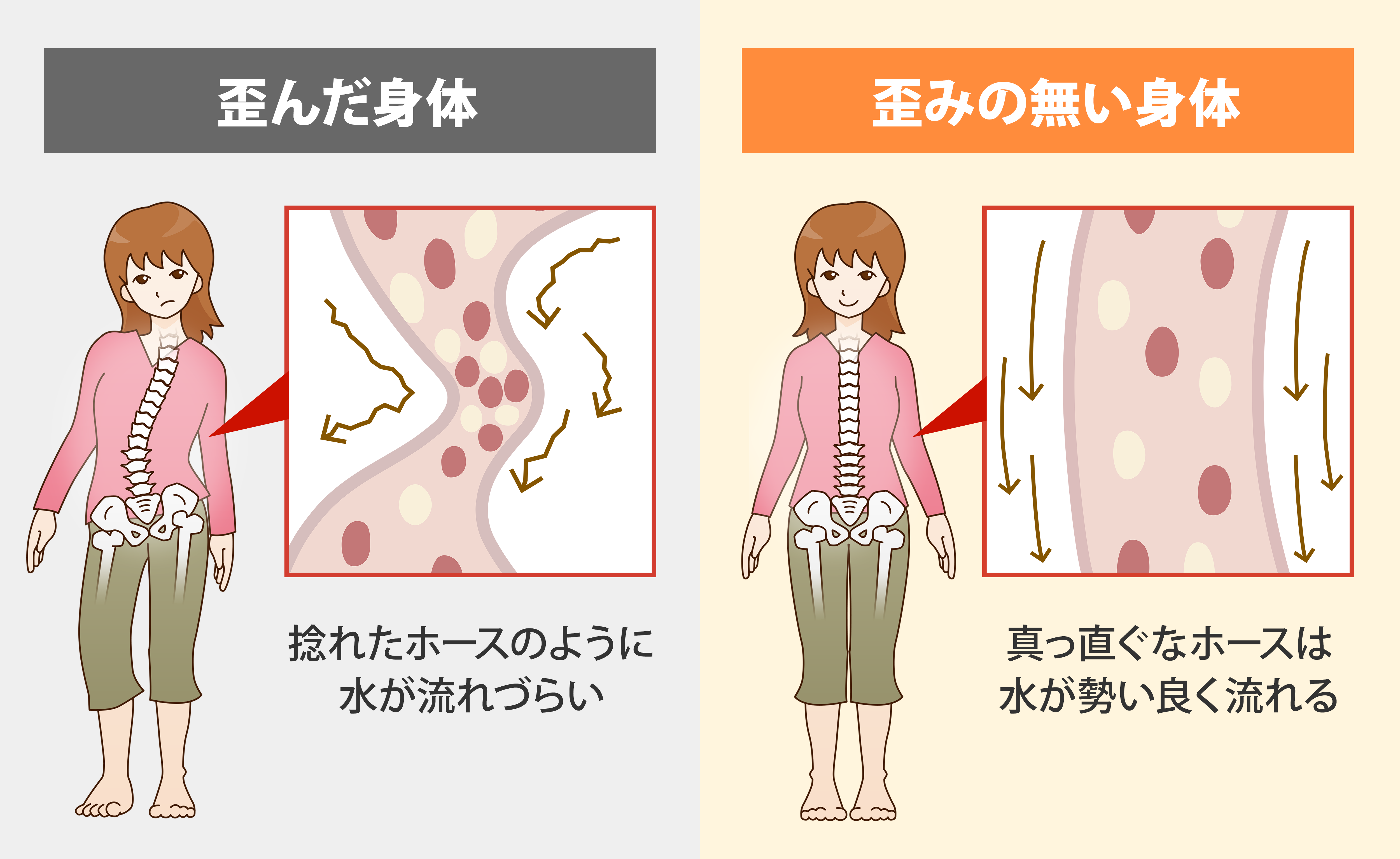 クワシオルコルの原因は何ですか?